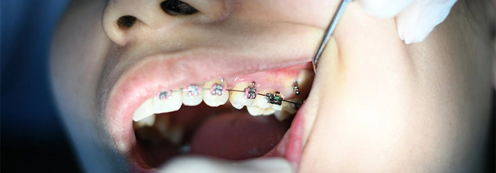 FC – Children’s Orthodontics In O’Fallon MO